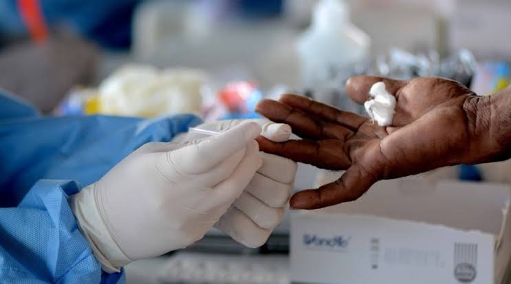 1.550 casos de Covid são registrados na Bahia nas últimas 24 horas