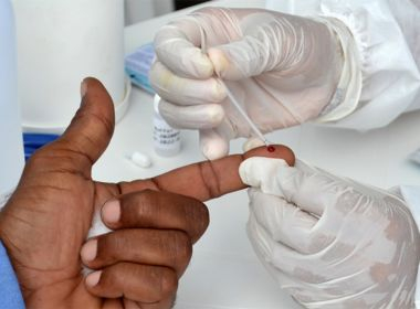 Feira de Santana: Quase 300 novos casos de HIV são registrados neste ano