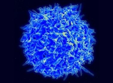 Imunidade em perigo: Novo coronavírus pode infectar e matar linfócitos, diz pesquisa