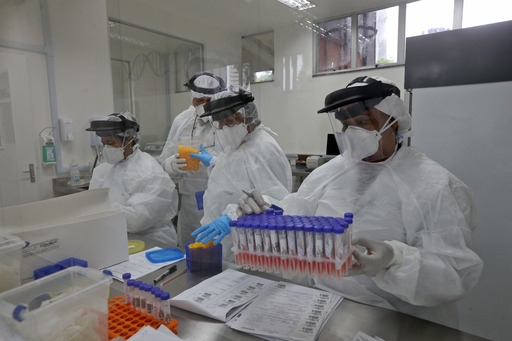 Lacen realiza mais de 20 mil testes para detecção de covid-19