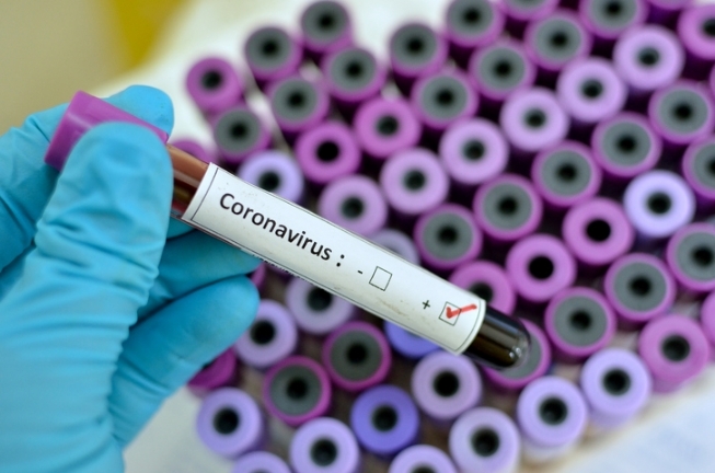 FEIRA DE SANTANA: Mulher de 37 anos, após contato com infectado local, adquire coronavírus