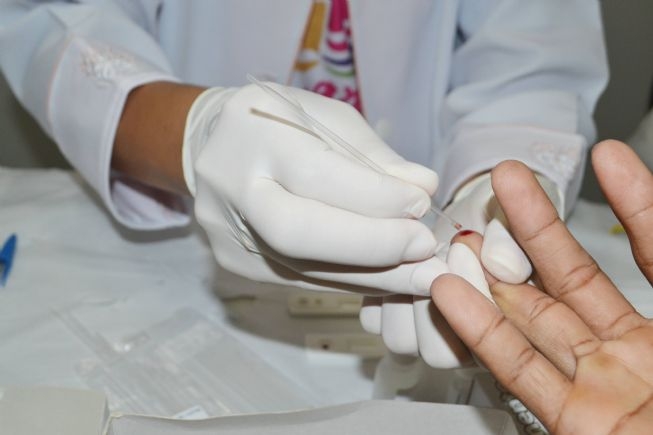 FEIRA DE SANTANA: Testes rápidos durante Micareta identificaram seis casos de sífilis