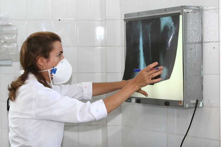 Tuberculose mata 4.500 pessoas todos os dias no mundo